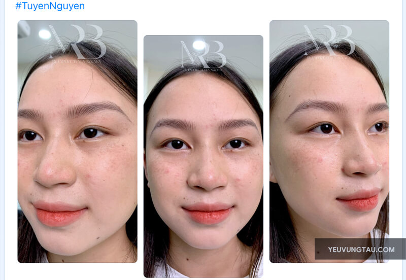 Rot Eyebrows & Beauty - Eyebrows By Tuyen Nguyen